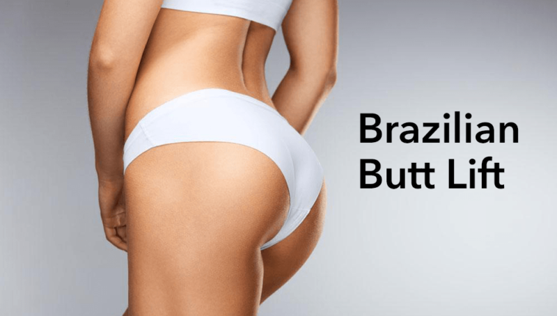 BBL Brazilian Butt Lift SIFSOF