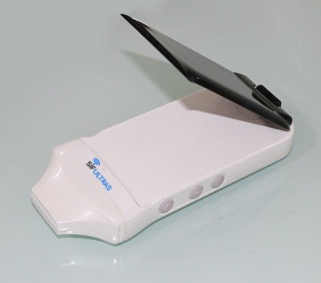 Built-in Screen Linear Ultrasound Scanner SIFULTRAS-5.4 FDA Linear