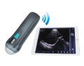 Sector Sweep Ultrasound Scanner SIFULTRAS-5.6 scan