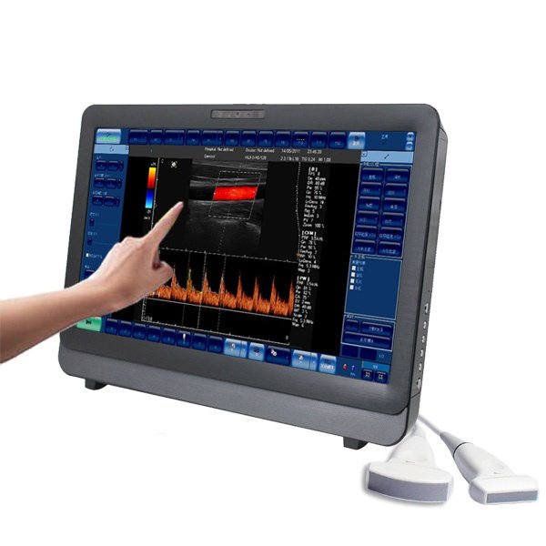 SIFULTRAS-6.4 Portable Fetal Heart Color Doppler Ultrasound Scanner main