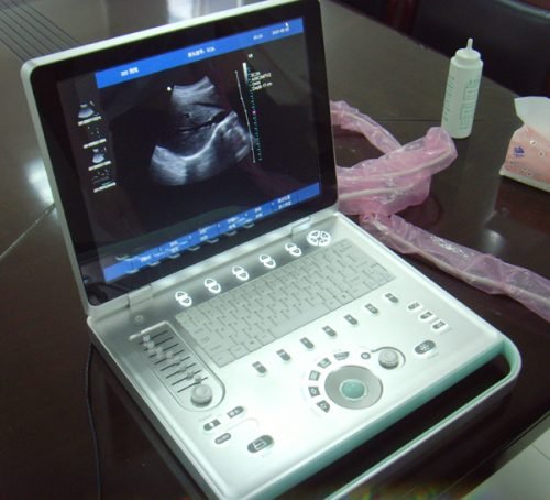 SIFULTRAS-6.2 Laptop Echocardiography Color Doppler Ultrasound Scanner main