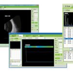 Ophthalmologischer Ultraschallscanner SIFULTRAS-8.1-Scan