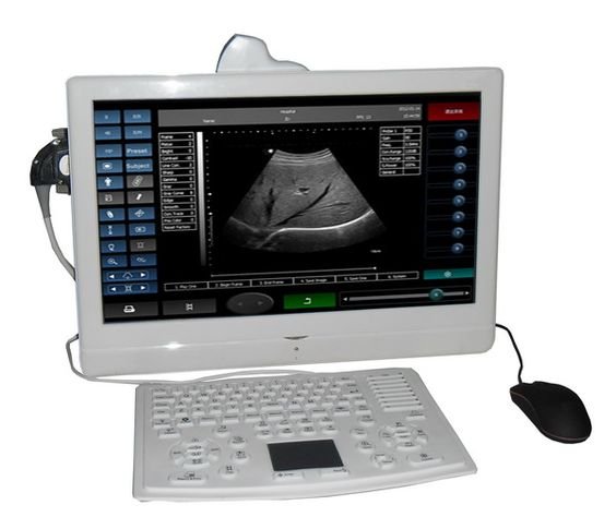 SIFULTRAS-4.1 Portable Wireless Pregnancy Ultrasound Scanner main