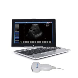 Laptop Ultrasound Scanner: SIFULTRAS-9.1, FDA 