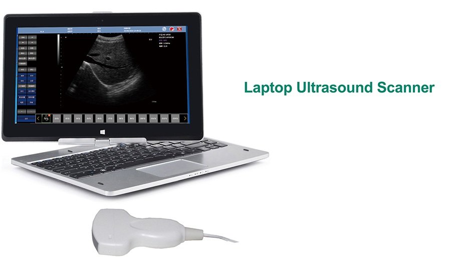 Laptop Ultrasound Scanner: SIFULTRAS-9.1, FDA  image