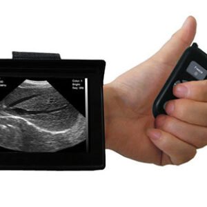 Veterinary Portable Wrist-Wear 3.5-5MHz Ultrasound Scanner SIFULTRAS-4.3 main
