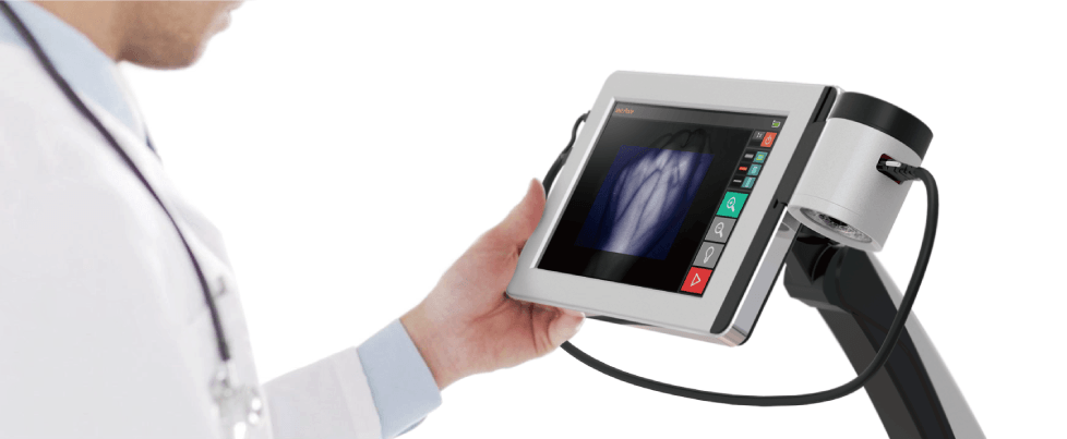 Portable Vein Detector FDA SIFVEIN-1.1 in use