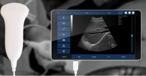 Portable Convex Ultrasound Scanner: SIFULTRAS-9.4