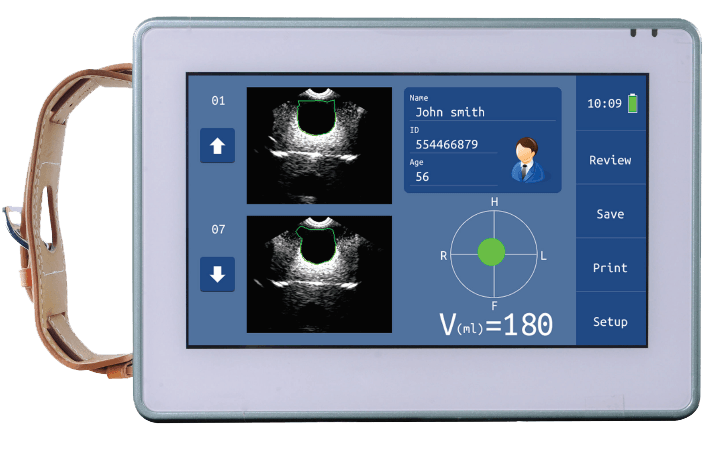 Urology Bladder Ultrasound scanner SIFULTRAS-5.54 FDA model