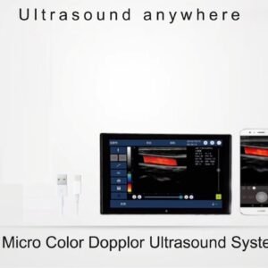 Color Convex 2.5-4.5 MHz Ultrasound Scanner SIFULTRAS-9.42, USB Doppler image