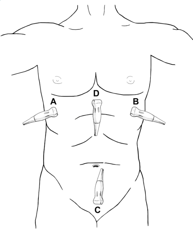 FAST - Focused Assessment with Sonography in Trauma - SIFSOF