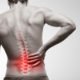 chronic back pain by facet arthropathy