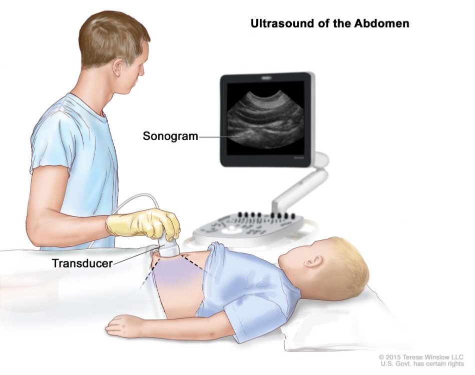 Ultrasound of the abdomen
