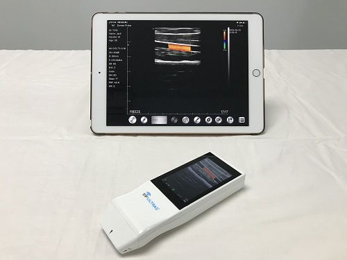 Built-in Screen Linear Ultrasound Scanner SIFULTRAS-5.14 Exterior Screen Compatible 