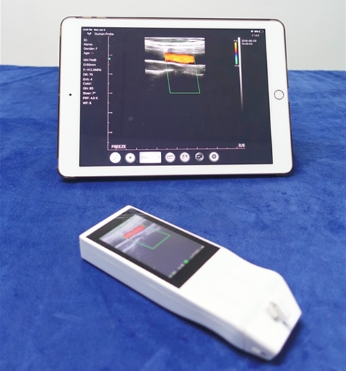 Built-in Screen Linear Ultrasound Scanner SIFULTRAS-5.14 dual screen