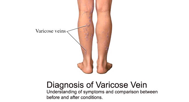 Desk Type Vein Finder SIFVEIN-5.41 Infrared Vein Imaging Transilluminator varicose vein 