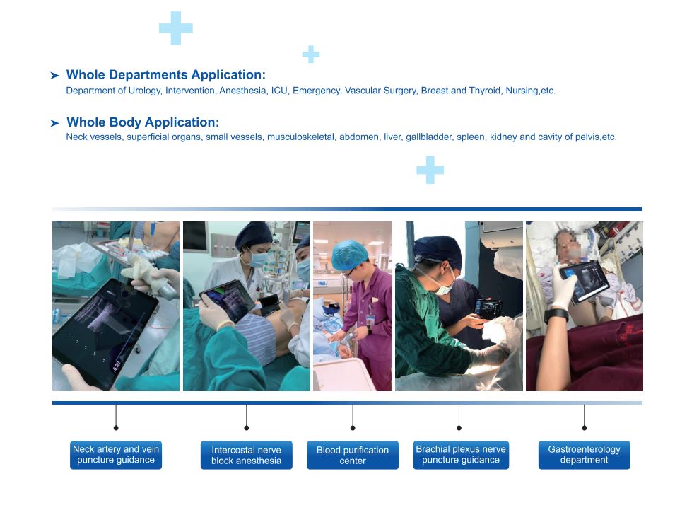 Color Doppler WiFi Linear Ultrasound Scanner 4-12 MHz SIFULTRAS-5.17 Clinical Applications 