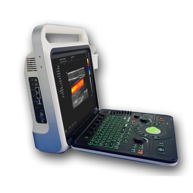 Color Doppler Convex Diagnostic Ultrasound Scanner SIFULTRAS-8.3