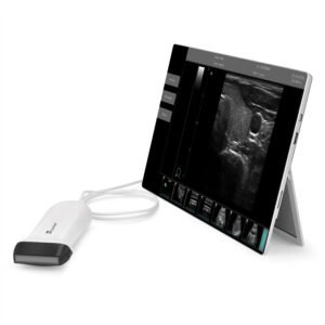 USB Linear 5-12MHz Ultrasound Scanner SIFULTRAS-9.53 linear
