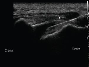 Caudal-epidural-ultrasound