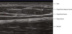 The-Superficial-Fascia-of-The-Abdomen-ultrasound.