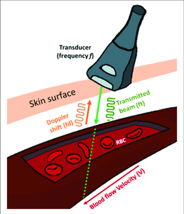 Procédures Guidées Par Ultrasons - Articles Médicaux Pour Scanners à ...