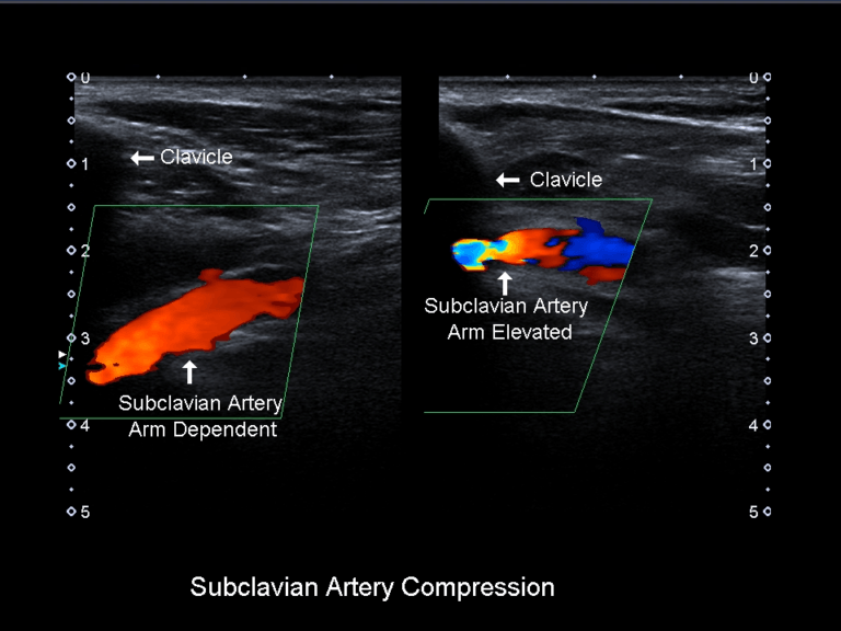 Traumatic Extremity Injuries Ultrasound-Guided Procedures - SIFSOF