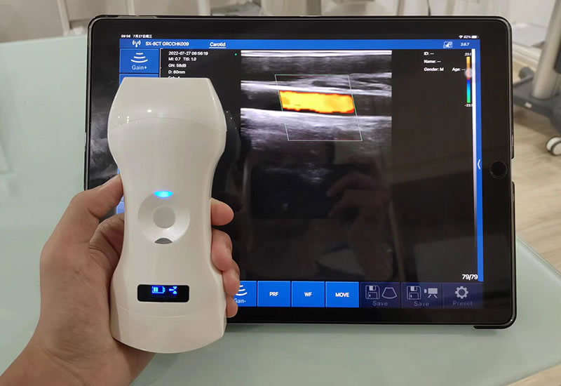 3-in-1 Wireless Ultrasound Scanner (CLP6) – Ultralife Medical Inc.