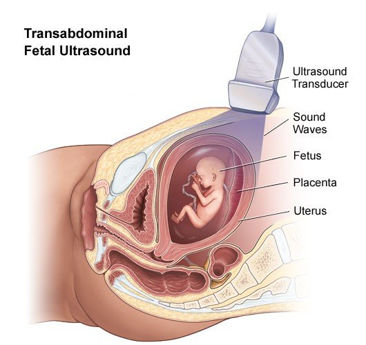 fetal ultrasound transabdominal
