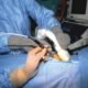 laparoscopy and ultrasound