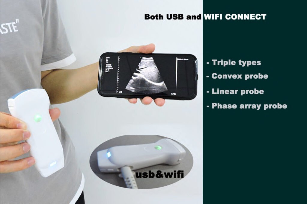 Color Doppler USB and Wireless 3 in 1 Ultrasound Scanner: SIFULTRAS-3.33 features