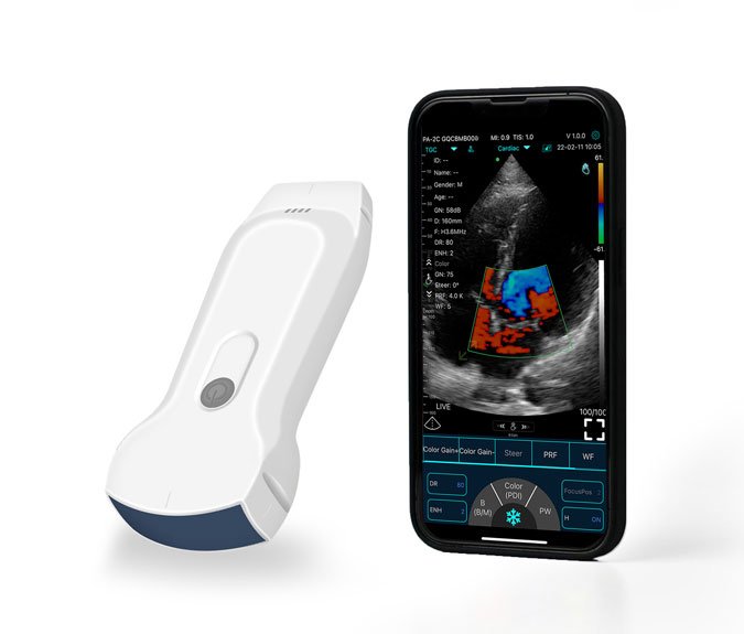 handheld ultrasound scanner