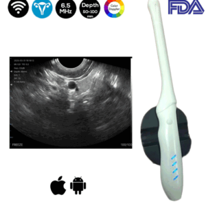 Wireless Transvaginal Ultrasound Scanner Color Doppler FDA SIFULTRAS-6.36