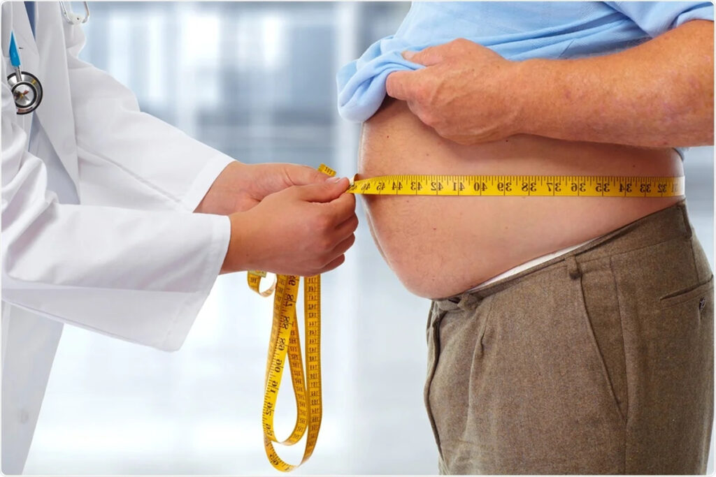 Obesity Related High Blood Pressure SIFSOF