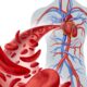 sickle cell disease
