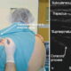 ultrasound guided suprascapular nerve block