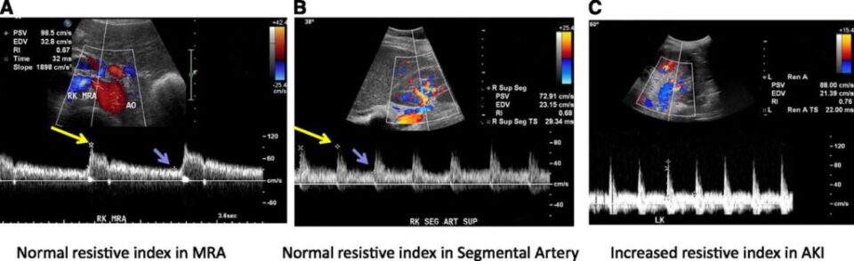 Doppler-imaging-and-resistive-index
