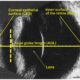 ophtalmic ultrasound of a dog's eyball