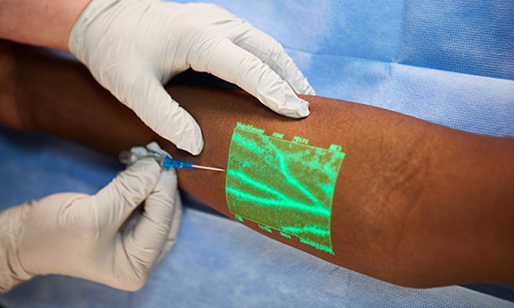 Efficacy of Vein Finder to Facilitate IV Contrast