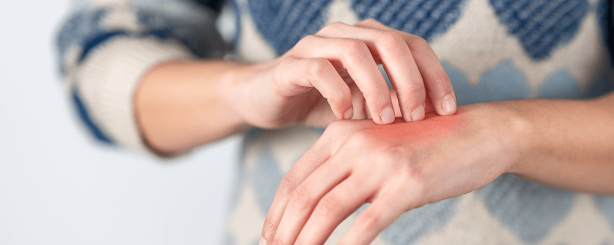 Rehabilitation following Hand Dysfunction '' Algodystrophy"
