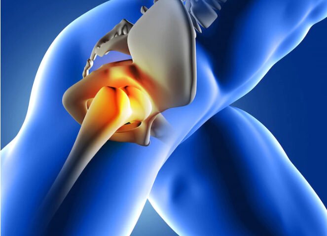 The acetabulofemoral joint (art. coxae) is the hip joint. It is the joint between the head of the femur and acetabulum of the pelvis and its primary function is to support the weight of the body in both static (e.g., standing) and dynamic (e.g., walking or running) postures.