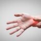 Laser Therapy for Carpal Tunnel Syndrome