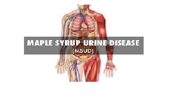 Laser Treatment for Maple Syrup Urine Disease