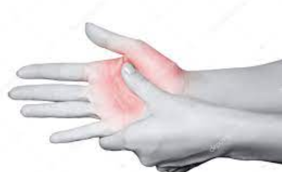 Tingling hands is an extremely common and bothersome symptom. Such tingling can sometimes be benign and temporary.