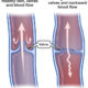 Vein Finding and Post-Phlebitic Syndrome