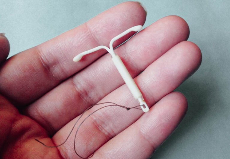 Among the most commonly used forms of contraception worldwide is the intrauterine contraceptive device (IUCD), sometimes known as the intrauterine device (IUD) and more often known as the coil. It stops pregnancies by endometrial lining thinness, stopping sperm movement, and avoidance of implantation.
