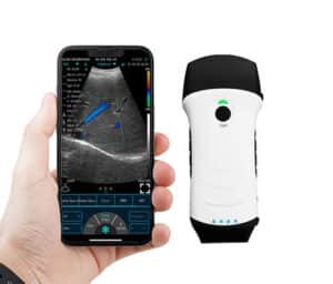 handheld portable ultrasound machine 