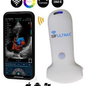 escáner de ultrasonido portátil de mano