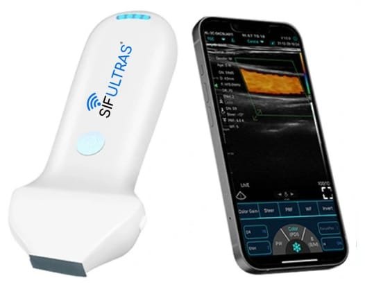 handheld portable ultrasound scanner