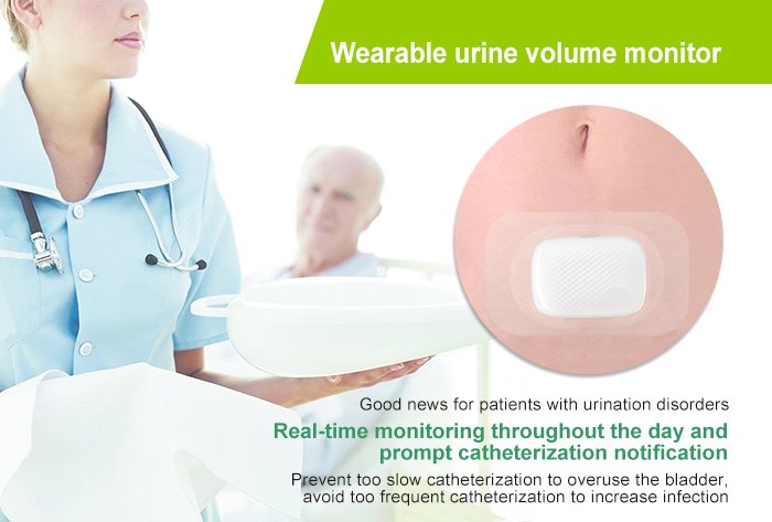 Wearable Real-time Urine Volume Monitor